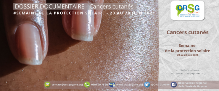 Veille-couverture-site-web-TWTER-16-740x310